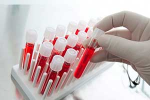 Ученые: мужская потенция зависит от группы крови